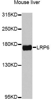 LRP6 Antibody - Western blot analysis of extracts of mouse liver, using LRP6 antibody at 1:1000 dilution. The secondary antibody used was an HRP Goat Anti-Rabbit IgG (H+L) at 1:10000 dilution. Lysates were loaded 25ug per lane and 3% nonfat dry milk in TBST was used for blocking. An ECL Kit was used for detection and the exposure time was 60s.