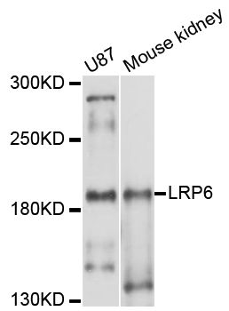 LRP6 Antibody - Western blot analysis of extracts of various cell lines, using LRP6 antibody at 1:1000 dilution. The secondary antibody used was an HRP Goat Anti-Rabbit IgG (H+L) at 1:10000 dilution. Lysates were loaded 25ug per lane and 3% nonfat dry milk in TBST was used for blocking. An ECL Kit was used for detection and the exposure time was 30s.