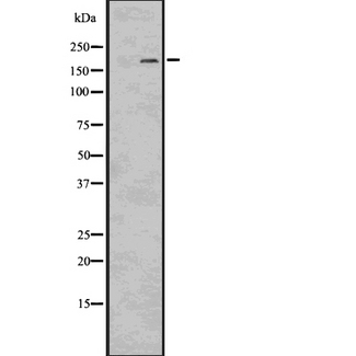 LRP6 Antibody - Western blot analysis of LRP6 using HepG2 whole cells lysates