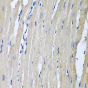LRP6 Antibody - Immunohistochemistry of paraffin-embedded Rat heart using LRP6 Polyclonal Antibody at dilution of 1:100 (40x lens).