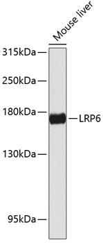 LRP6 Antibody - Western blot analysis of extracts of mouse liver using LRP6 Polyclonal Antibody at dilution of 1:1000.