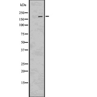 LRP6 Antibody - Western blot analysis of Phospho-LRP6 (Ser1490) using HeLa whole cells lysates