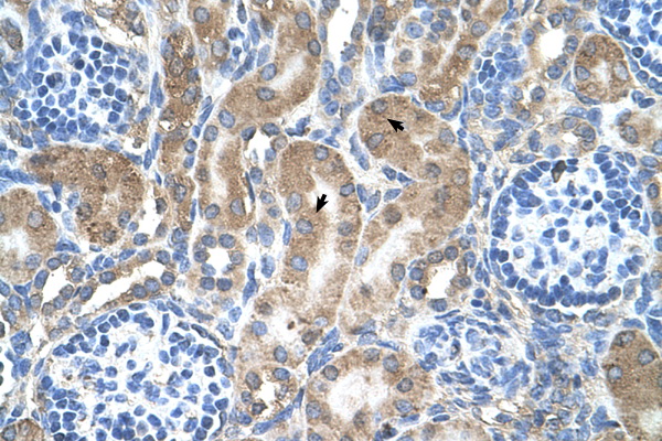 LRPAP1 Antibody - LRPAP1 antibody ARP45276_T100-NP_002328-LRPAP1(low density lipoprotein receptor-related protein associated protein 1) Antibody IHC of formalin-fixed, paraffin-embedded human Kidney. Positive label: Epithelial cells of renal tubule indicated with arrows. Antibody concentration 4-8 ug/ml. Magnification 400X.  This image was taken for the unconjugated form of this product. Other forms have not been tested.