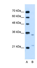 LRPAP1 Antibody - LRPAP1 antibody ARP45276_T100-NP_002328-LRPAP1(low density lipoprotein receptor-related protein associated protein 1) Antibody Western blot of Jurkat lysate.  This image was taken for the unconjugated form of this product. Other forms have not been tested.