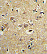 LRPAP1 Antibody - Formalin-fixed and paraffin-embedded human brain tissue with LRPAP1 Antibody , which was peroxidase-conjugated to the secondary antibody, followed by DAB staining. This data demonstrates the use of this antibody for immunohistochemistry; clinical relevance has not been evaluated.