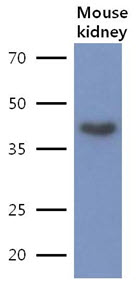 LRPAP1 Antibody - The lysate of Mouse kidney(40ug) were resolved by SDS-PAGE, transferred to PVDF membrane and probed with anti-human LRPAP1 antibody (1:500). Proteins were visualized using a goat anti-mouse secondary antibody conjugated to HRP and an ECL detection system.