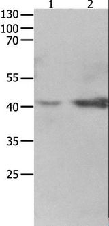 LRPAP1 Antibody - Western blot analysis of 293T cell and fetal kidney tissue, using LRPAP1 Polyclonal Antibody at dilution of 1:1600.