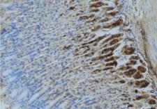 LRPAP1 Antibody - 1:100 staining human gastric tissue by IHC-P. The sample was formaldehyde fixed and a heat mediated antigen retrieval step in citrate buffer was performed. The sample was then blocked and incubated with the antibody for 1.5 hours at 22°C. An HRP conjugated goat anti-rabbit antibody was used as the secondary.
