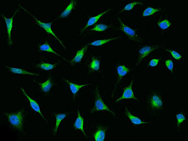 LRPAP1 Antibody - Immunofluorescence staining of LRPAP1 in HeLa cells. Cells were fixed with 4% PFA, permeabilzed with 0.1% Triton X-100 in PBS, blocked with 10% serum, and incubated with rabbit anti-Human LRPAP1 polyclonal antibody (dilution ratio 1:1000) at 4°C overnight. Then cells were stained with the Alexa Fluor 488-conjugated Goat Anti-rabbit IgG secondary antibody (green) and counterstained with DAPI (blue). Positive staining was localized to Cytoplasm.