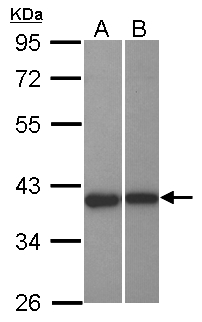 LRPB7 / LRRC23 Antibody - Sample (30 ug of whole cell lysate) A: NT2D1 B: U87-MG 10% SDS PAGE LRRC23 antibody diluted at 1:1000