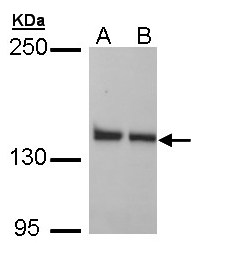 LRPPRC Antibody - Sample (30 ug of whole cell lysate). A: H1299, B: HeLa. 5% SDS PAGE. LRPPRC antibody diluted at 1:1000