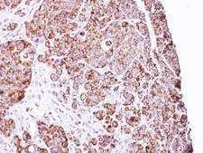 LRPPRC Antibody - IHC of paraffin-embedded SW480 Xenograft using LRP130 antibody at 1:100 dilution.