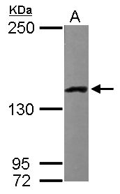 LRPPRC Antibody - Sample (50 ug of whole cell lysate). A: Mouse brain. 5% SDS PAGE. LRPPRC antibody diluted at 1:5000.