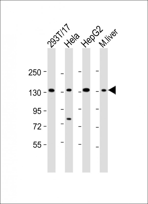LRPPRC Antibody - All lanes: Anti-LRPPRC Antibody (Center) at 1:2000 dilution. Lane 1: 293T/17 whole cell lysate. Lane 2: HeLa whole cell lysate. Lane 3: HepG2 whole cell lysate. Lane 4: mouse liver lysate Lysates/proteins at 20 ug per lane. Secondary Goat Anti-Rabbit IgG, (H+L), Peroxidase conjugated at 1:10000 dilution. Predicted band size: 158 kDa. Blocking/Dilution buffer: 5% NFDM/TBST.