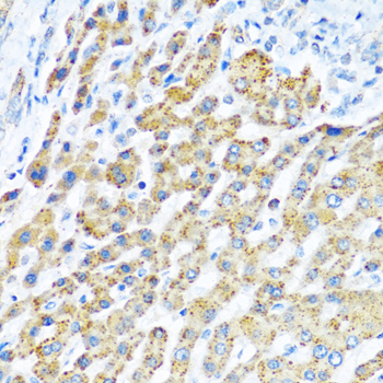LRPPRC Antibody - Immunohistochemistry of paraffin-embedded human liver tissue.