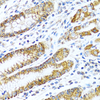 LRPPRC Antibody - Immunohistochemistry of paraffin-embedded human stomach tissue.