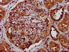 LRPPRC Antibody - Immunohistochemistry image at a dilution of 1:400 and staining in paraffin-embedded human kidney tissue performed on a Leica BondTM system. After dewaxing and hydration, antigen retrieval was mediated by high pressure in a citrate buffer (pH 6.0) . Section was blocked with 10% normal goat serum 30min at RT. Then primary antibody (1% BSA) was incubated at 4 °C overnight. The primary is detected by a biotinylated secondary antibody and visualized using an HRP conjugated SP system.
