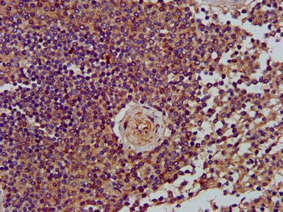LRPPRC Antibody - Immunohistochemistry image at a dilution of 1:400 and staining in paraffin-embedded human spleen tissue performed on a Leica BondTM system. After dewaxing and hydration, antigen retrieval was mediated by high pressure in a citrate buffer (pH 6.0) . Section was blocked with 10% normal goat serum 30min at RT. Then primary antibody (1% BSA) was incubated at 4 °C overnight. The primary is detected by a biotinylated secondary antibody and visualized using an HRP conjugated SP system.
