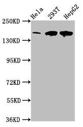 LRPPRC Antibody - Positive Western Blot detected in Hela whole cell lysate, 293T whole cell lysate, HepG2 whole cell lysate. All lanes: LRPPRC antibody at 4 µg/ml Secondary Goat polyclonal to rabbit IgG at 1/50000 dilution. Predicted band size: 158 KDa. Observed band size: 158 KDa