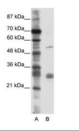 LRRC14 Antibody - A: Marker, B: HepG2 Cell Lysate.  This image was taken for the unconjugated form of this product. Other forms have not been tested.