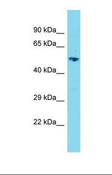 LRRC14B Antibody - Western blot of Fetal Kidney. LRRC36 antibody dilution 1.0 ug/ml.  This image was taken for the unconjugated form of this product. Other forms have not been tested.