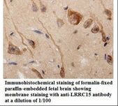 LRRC15 Antibody