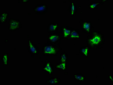 LRRC15 Antibody - Immunofluorescence staining of SH-SY5Y cells with LRRC15 Antibody at 1:133, counter-stained with DAPI. The cells were fixed in 4% formaldehyde, permeabilized using 0.2% Triton X-100 and blocked in 10% normal Goat Serum. The cells were then incubated with the antibody overnight at 4°C. The secondary antibody was Alexa Fluor 488-congugated AffiniPure Goat Anti-Rabbit IgG(H+L).