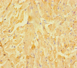 LRRC15 Antibody - Immunohistochemistry of paraffin-embedded human heart tissue using LRRC15 Antibody at dilution of 1:100