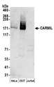 LRRC16 / CARMIL Antibody - Detection of human CARMIL by western blot. Samples: Whole cell lysate (50 µg) from HeLa, HEK293T, and Jurkat cells prepared using NETN lysis buffer. Antibodies: Affinity purified rabbit anti-CARMIL antibody used for WB at 0.1 µg/ml. Detection: Chemiluminescence with an exposure time of 3 minutes.