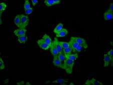 LRRC16 / CARMIL Antibody - Immunofluorescence staining of HepG2 cells diluted at 1:66, counter-stained with DAPI. The cells were fixed in 4% formaldehyde, permeabilized using 0.2% Triton X-100 and blocked in 10% normal Goat Serum. The cells were then incubated with the antibody overnight at 4°C.The Secondary antibody was Alexa Fluor 488-congugated AffiniPure Goat Anti-Rabbit IgG (H+L).