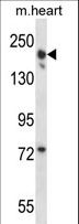LRRC16B Antibody - LRRC16B Antibody western blot of mouse heart tissue lysates (35 ug/lane). The LRRC16B antibody detected the LRRC16B protein (arrow).