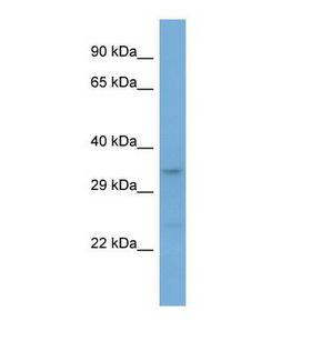 LRRC17 Antibody - Western blot of Human HeLa. LRRC17 antibody dilution 1.0 ug/ml.  This image was taken for the unconjugated form of this product. Other forms have not been tested.