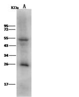 LRRC17 Antibody - Anti-LRRC17 rabbit polyclonal antibody at 1:500 dilution. Lane A: MCF7 Whole Cell Lysate. Lysates/proteins at 30 ug per lane. Secondary: Goat Anti-Rabbit IgG (H+L)/HRP at 1/10000 dilution. Developed using the ECL technique. Performed under reducing conditions. Predicted band size: 52 kDa. Observed band size: 54 kDa.