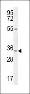 LRRC18 Antibody - LRC18 Antibody western blot of mouse bladder tissue lysates (35 ug/lane). The LRC18 antibody detected the LRC18 protein (arrow).