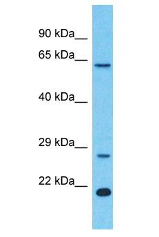 LRRC18 Antibody - LRRC18 antibody Western Blot of Colorectal Tumor. Antibody dilution: 1 ug/ml.  This image was taken for the unconjugated form of this product. Other forms have not been tested.
