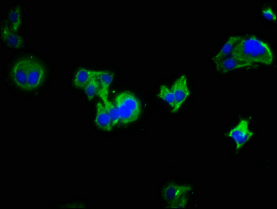 LRRC19 Antibody - Immunofluorescence staining of HepG2 cells with LRRC19 Antibody at 1:333, counter-stained with DAPI. The cells were fixed in 4% formaldehyde, permeabilized using 0.2% Triton X-100 and blocked in 10% normal Goat Serum. The cells were then incubated with the antibody overnight at 4°C. The secondary antibody was Alexa Fluor 488-congugated AffiniPure Goat Anti-Rabbit IgG(H+L).
