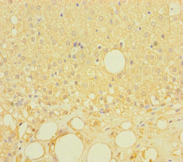 LRRC19 Antibody - Immunohistochemistry of paraffin-embedded human adrenal gland tissue using LRRC19 Antibody at dilution of 1:100
