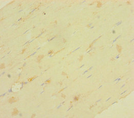 LRRC19 Antibody - Immunohistochemistry of paraffin-embedded human skeletal muscle tissue using LRRC19 Antibody at dilution of 1:100