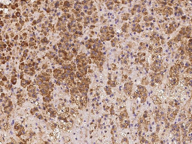 LRRC19 Antibody - Immunochemical staining of human LRRC19 in human adrenal gland with rabbit polyclonal antibody at 1:500 dilution, formalin-fixed paraffin embedded sections.