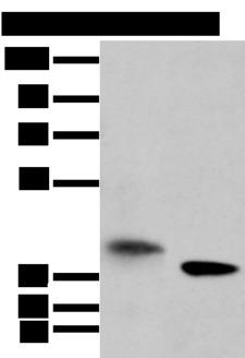 LRRC19 Antibody - Western blot analysis of A172 cell and mouse kidney tissue  using LRRC19 Polyclonal Antibody at dilution of 1:450