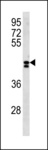 LRRC2 Antibody - LRRC2 Antibody western blot of NCI-H460 cell line lysates (35 ug/lane). The LRRC2 antibody detected the LRRC2 protein (arrow).