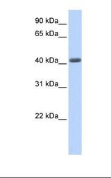 LRRC2 Antibody - Fetal muscle lysate. Antibody concentration: 1.0 ug/ml. Gel concentration: 12%.  This image was taken for the unconjugated form of this product. Other forms have not been tested.