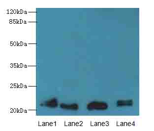 LRRC20 Antibody - Western blot. All lanes: LRRC20 antibody at 1 ug/ml. Lane 1: Jurkat whole cell lysate. Lane 2: Mouse heart tissue. Lane 3: Mouse spleen tissue. Lane 4: U937 whole cell lysate. Secondary Goat polyclonal to Rabbit IgG at 1:10000 dilution. Predicted band size: 21 kDa. Observed band size: 21 kDa.