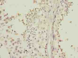 LRRC20 Antibody - Immunohistochemistry of paraffin-embedded human testis tissue using antibody at dilution of 1:100.