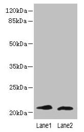 LRRC20 Antibody - Western blot All lanes: LRRC20 antibody at 1µg/ml Lane 1: Jurkat whole cell lysate Lane 2: Mouse heart tissue Lane 3: Mouse spleen tissue Lane 4: U937 whole cell lysate Secondary Goat polyclonal to rabbit IgG at 1/10000 dilution Predicted band size: 21, 15 kDa Observed band size: 21 kDa