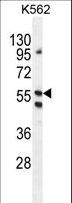 LRRC21 Antibody - LRIT1 Antibody western blot of K562 cell line lysates (35 ug/lane). The LRIT1 antibody detected the LRIT1 protein (arrow).
