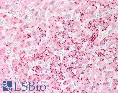 LRRC25 Antibody - Human Liver: Formalin-Fixed, Paraffin-Embedded (FFPE)