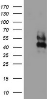 LRRC25 Antibody - HEK293T cells were transfected with the pCMV6-ENTRY control (Left lane) or pCMV6-ENTRY LRRC25 (Right lane) cDNA for 48 hrs and lysed. Equivalent amounts of cell lysates (5 ug per lane) were separated by SDS-PAGE and immunoblotted with anti-LRRC25.