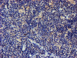 LRRC25 Antibody - IHC of paraffin-embedded Human lymphoma tissue using anti-LRRC25 mouse monoclonal antibody.