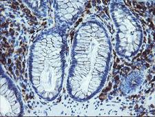 LRRC25 Antibody - IHC of paraffin-embedded Human colon tissue using anti-LRRC25 mouse monoclonal antibody.